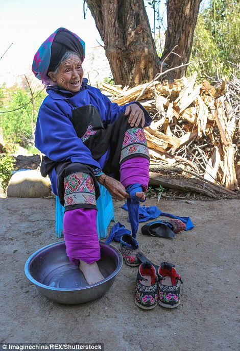 這位老奶奶是全中國 最後一位纏足婦女 過去踩成 血肉模糊的腳掌 現在模樣讓人超心疼 Bomb01